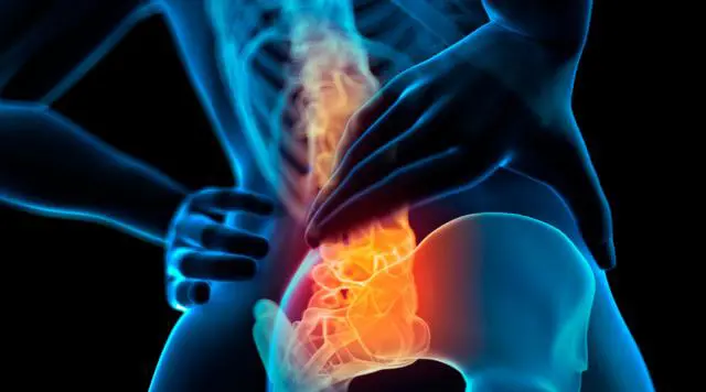 Digital image of lower back pain